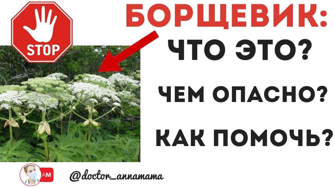 Жителей Коми научат оказывать первую помощь пострадавшим от борщевика.